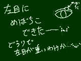 [2010-05-14 14:50:04] めばちこできた；ω；左目に。